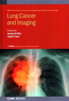Lung cancer and imaging / edited by Ayman El-Baz, Jasjit S Suri.